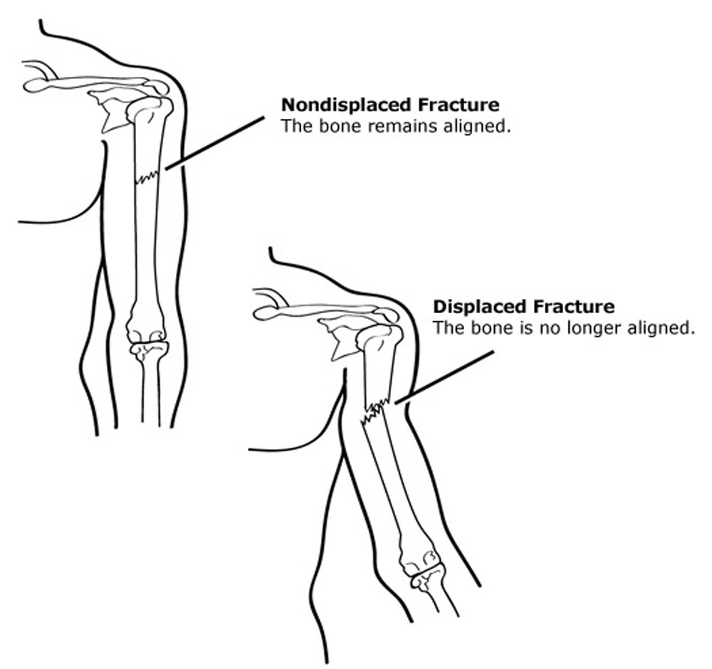 Mica Hardware  Basic Safety and First Aid